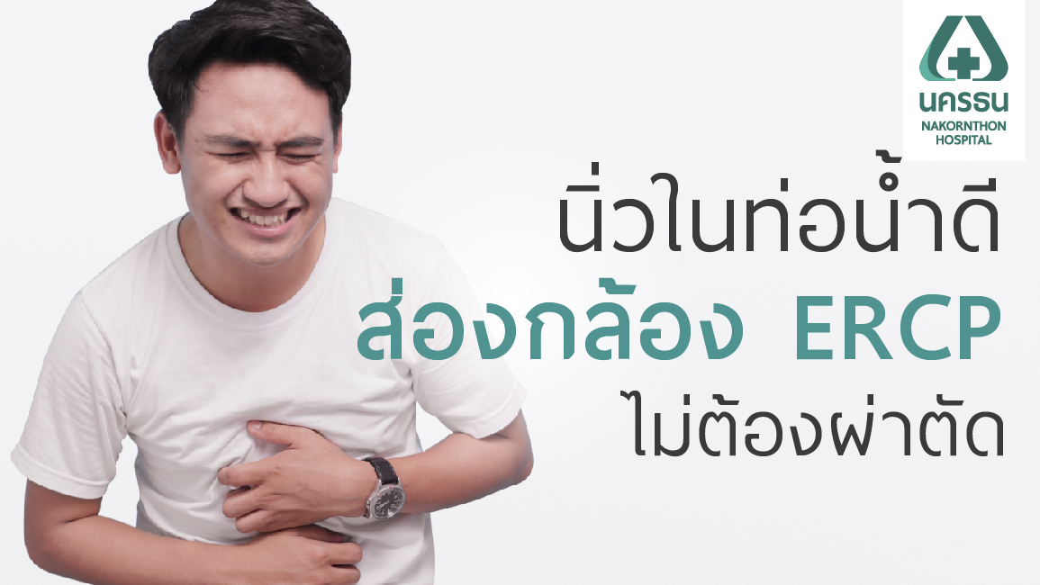 ERCP รักษา “นิ่วในท่อน้ำดี” ไว ไม่ปวดท้องเรื้องรัง